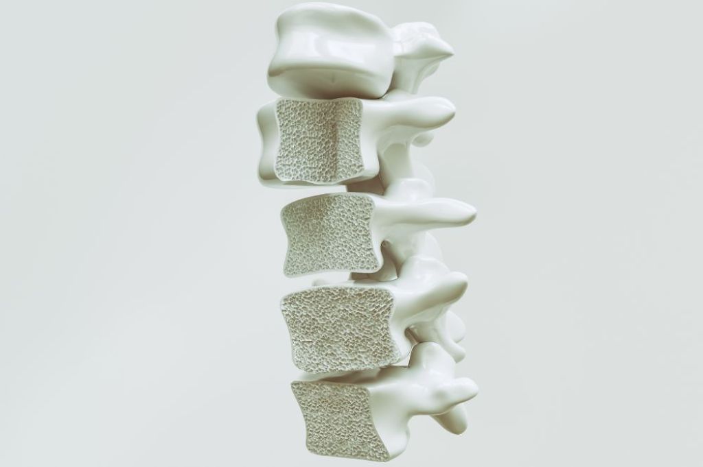 ilustrasi osteoporosis 2 - KedaiKata.jpg